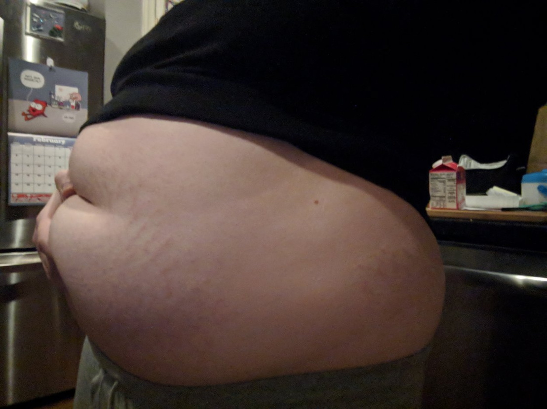 Stretched Marked Gut #2.jpg